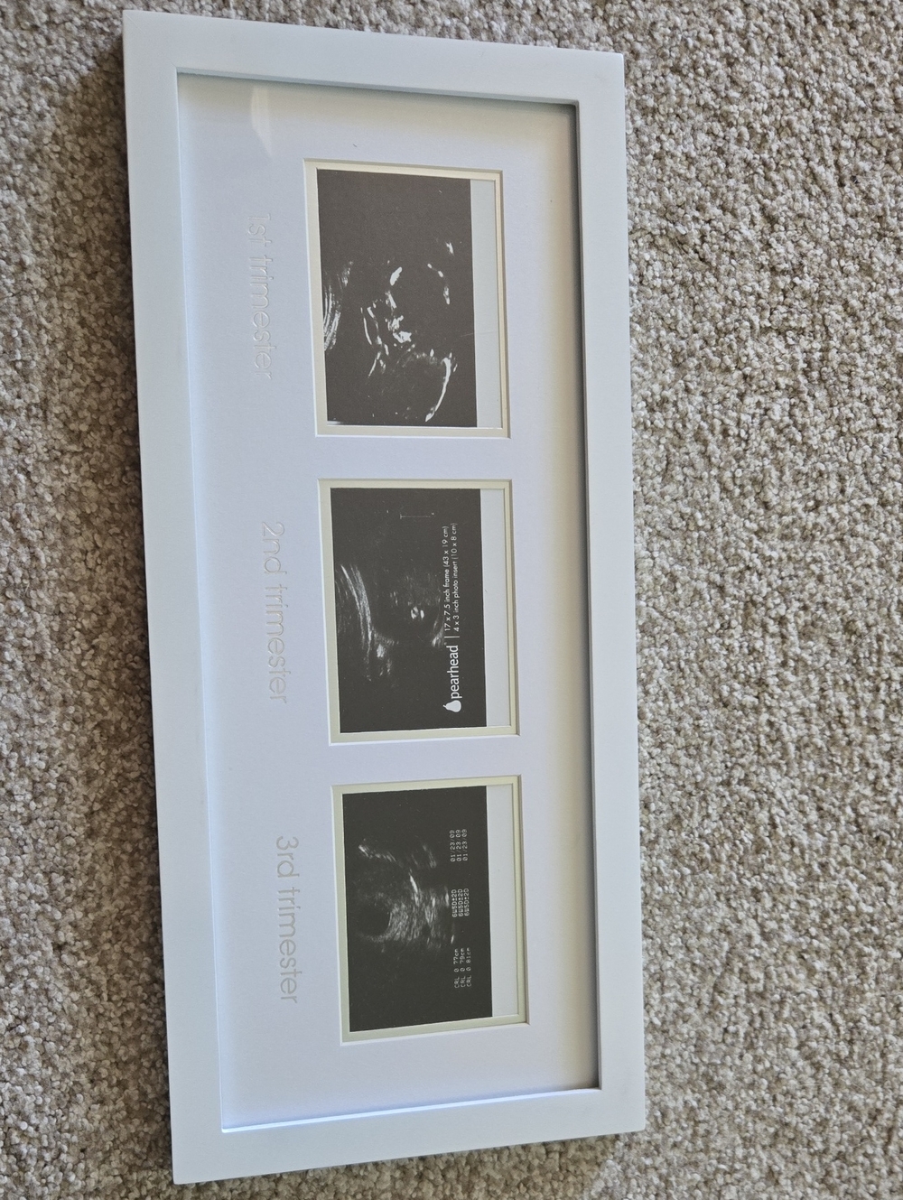 Ultrasound Photo Collage